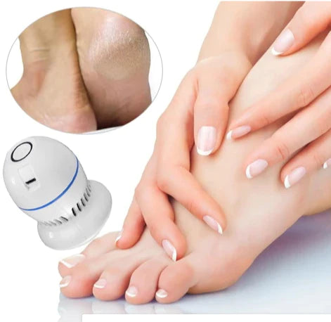 Removedor de calos e rachaduras Beauty Feet